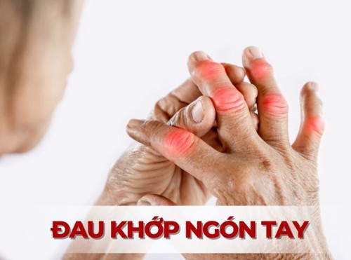 Đau khớp ngón tay: Nguyên nhân và phương pháp điều trị